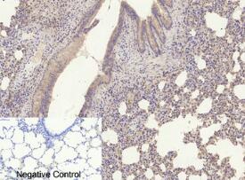 ihc Ab.jpg