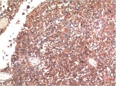 BT-MCA1185 Immunohistochemical 2.jpg